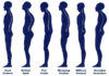 Best Posture Corrector Brace Reviews For Men & Women