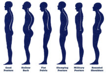 Best Posture Corrector Brace Reviews For Men & Women