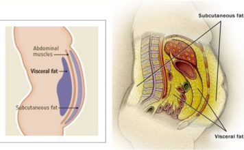 TOFI – Thin Outside Fat Inside Thin Outside Fat Inside