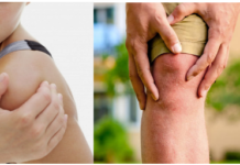 Joint Pain Relief Codes Review