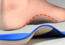 Best Shoe Inserts for Standing All Day